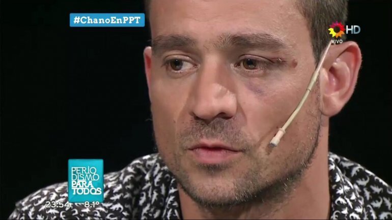 Imagen de Chano de Tan Biónica habló con Jorge Lanata Imagen de Chano de Tan Biónica habló con Jorge Lanata