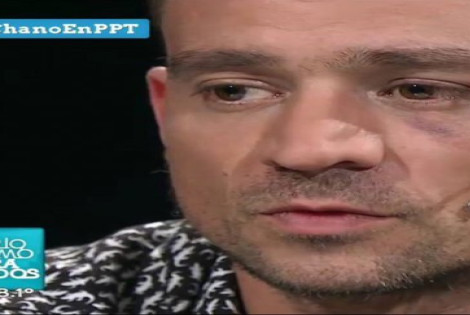 Imagen de Chano de Tan Bi&oacute;nica habl&oacute; con Jorge Lanata