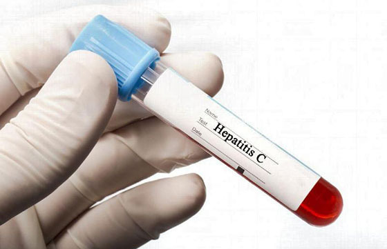 Imagen de Campaña de detección gratuita de hepatitis C Imagen de Campaña de detección gratuita de hepatitis C