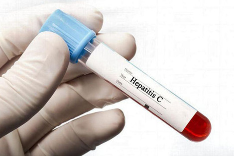 Imagen de Campaña de detección gratuita de hepatitis C