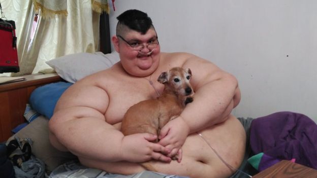 Imagen de Los sue&ntilde;os y la lucha de Pedro Franco el hombre m&aacute;s obeso del mundo