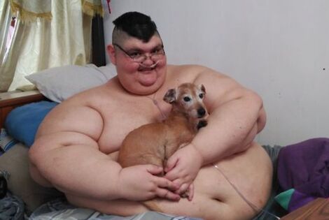 Imagen de Los sue&ntilde;os y la lucha de Pedro Franco el hombre m&aacute;s obeso del mundo