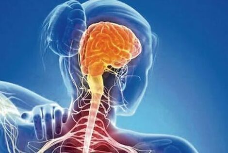 Imagen de Buena noticia para la Esclerosis M&uacute;ltiple