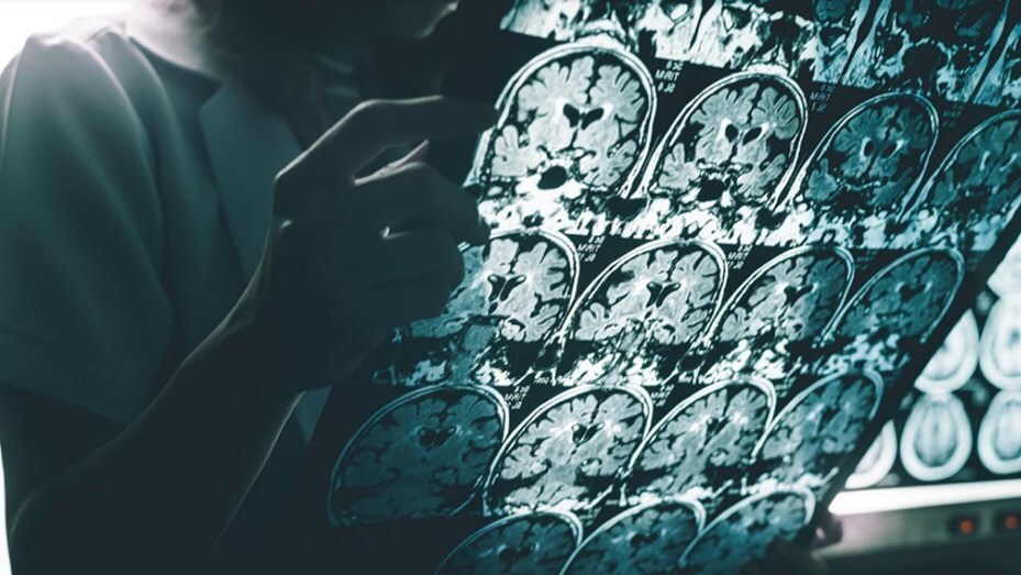 Imagen de Logran retrasar el Alzheimer en ratones