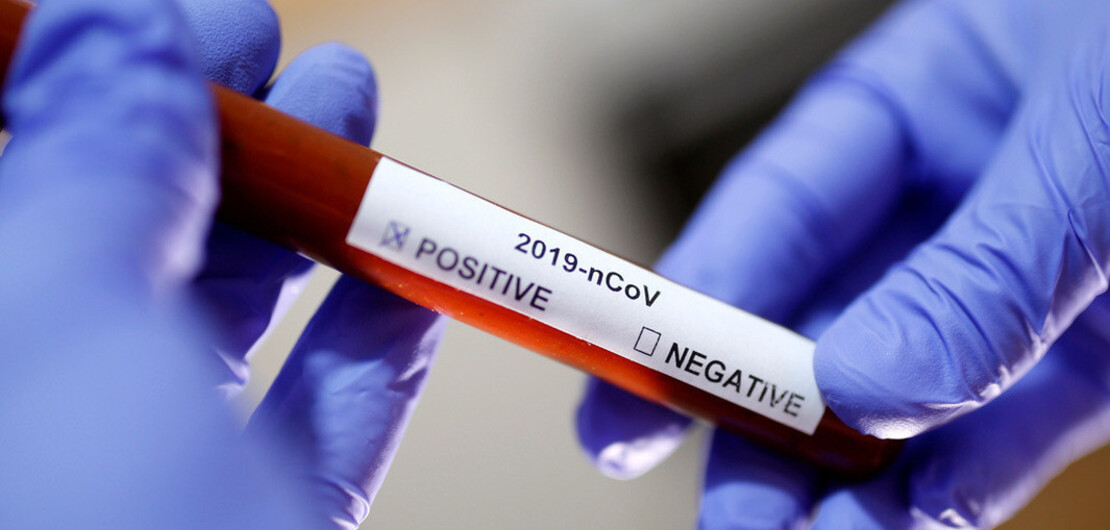 Imagen de OMS: hay más de 5.000 muertos por coronavirus