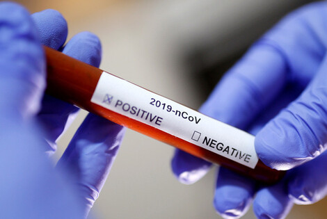 Imagen de OMS: hay más de 5.000 muertos por coronavirus