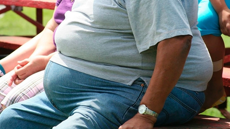 Imagen de Piden que la obesidad sea declarada enfermedad