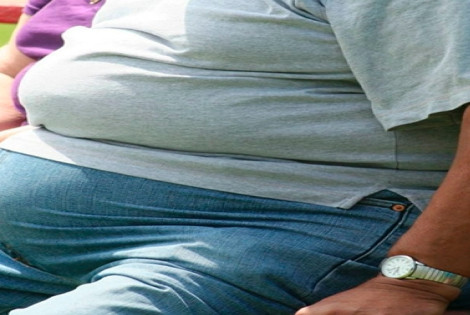Imagen de Piden que la obesidad sea declarada enfermedad