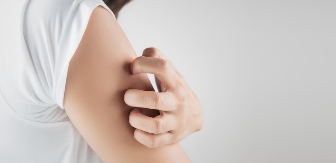 Imagen de Psoriasis: la importancia de diagnosticar y tratar a tiempo