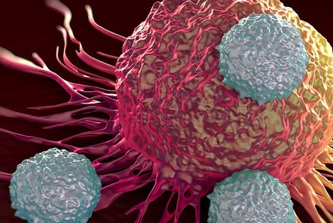 Imagen de Diagnosticar la enfermedad en etapas precoces incrementa no sólo la posibilidad de curación, sino también la menor necesidad de tratamientos agresivos Imagen de Diagnosticar la enfermedad en etapas precoces incrementa no sólo la posibilidad de curación, sino también la menor necesidad de tratamientos agresivos