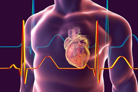 Imagen de Informe sobre Diabetes 2 y Riesgo Cardiovascular