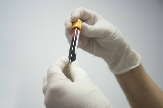 Imagen de VIH/Sida, realizan pruebas de detecci&oacute;n