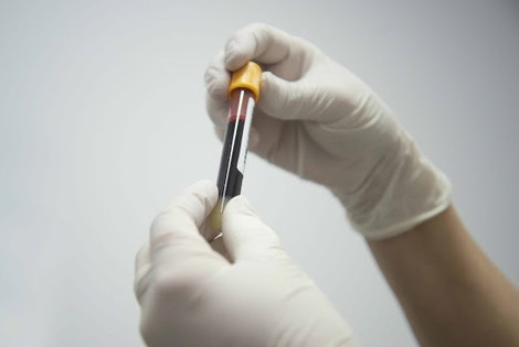 Imagen de VIH/Sida, realizan pruebas de detección