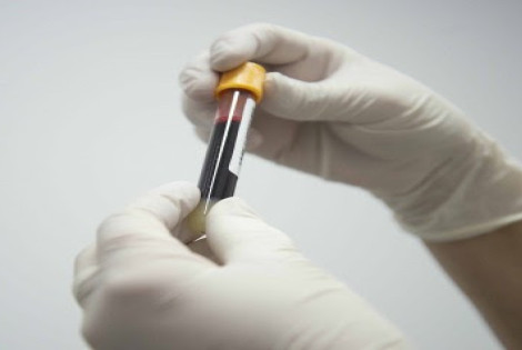 Imagen de VIH/Sida, realizan pruebas de detecci&oacute;n