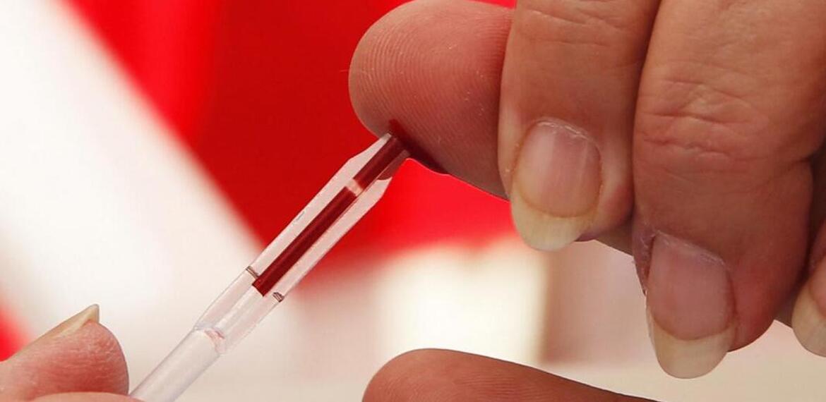 En Argentina 140.000 personas viven con VIH y, cada a&ntilde;o, 5.300 adquieren el virus. Por eso es muy importante realizarse el test. (Foto AFP)