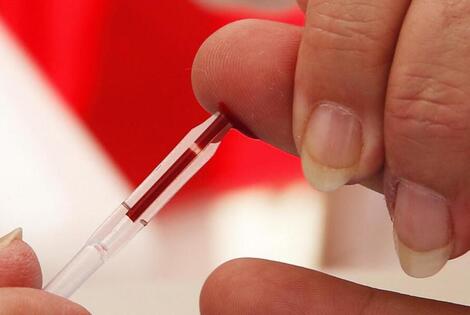 En Argentina 140.000 personas viven con VIH y, cada a&ntilde;o, 5.300 adquieren el virus. Por eso es muy importante realizarse el test. (Foto AFP)
