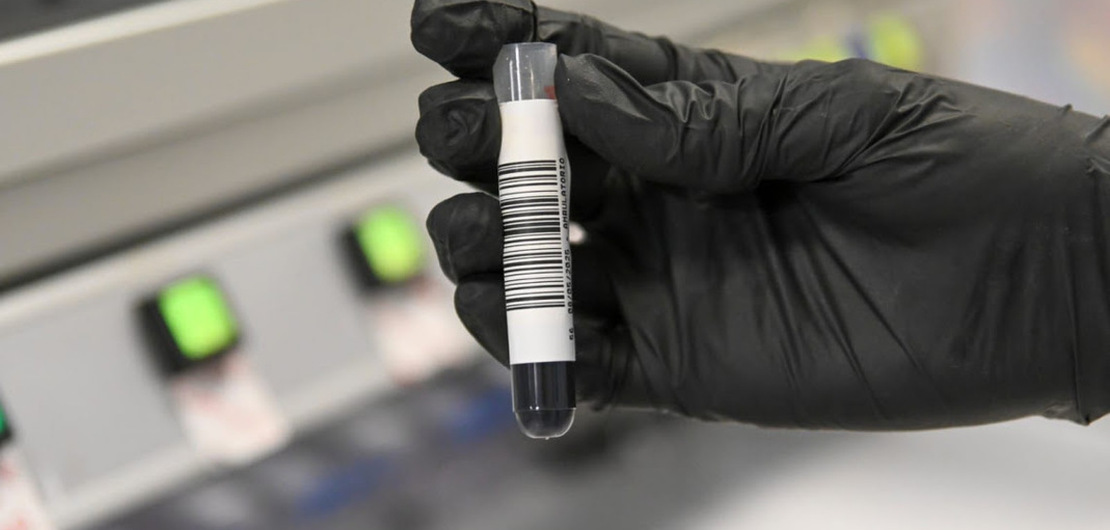 Imagen de Estudios gen&eacute;ticos de c&aacute;ncer