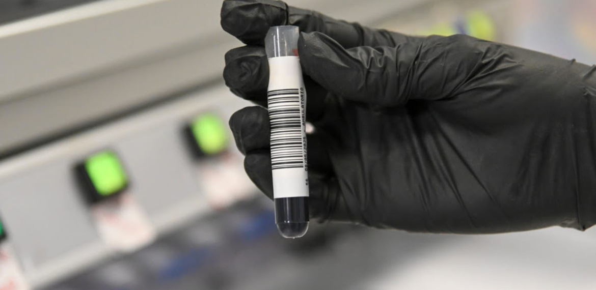 Imagen de Estudios genéticos de cáncer