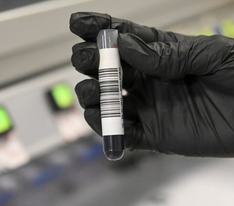 Imagen de Estudios genéticos de cáncer