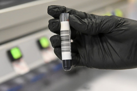 Imagen de Estudios genéticos de cáncer
