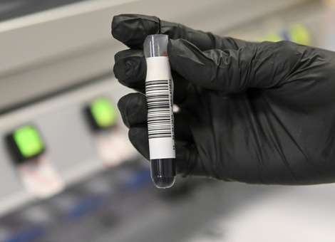 Imagen de Estudios genéticos de cáncer